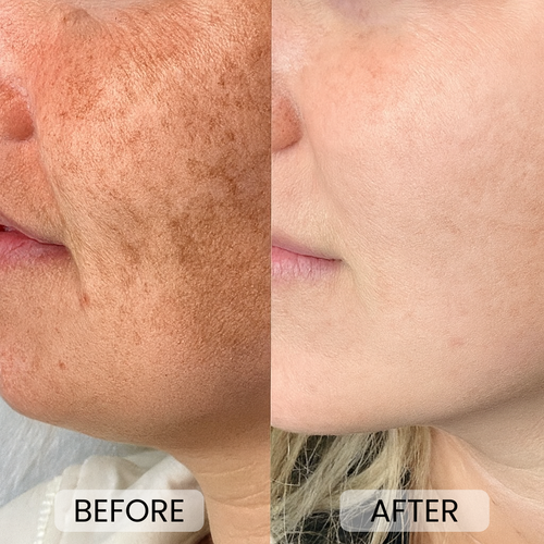 Anti Aging Moisturizer